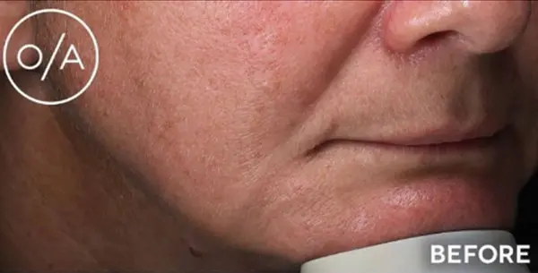 What is Lorem Ipsum?